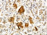 MRPL10 Antibody in Immunohistochemistry (Paraffin) (IHC (P))