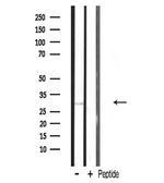 MRPL10 Antibody in Western Blot (WB)