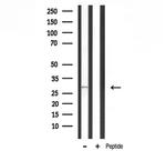 MRPL10 Antibody in Western Blot (WB)