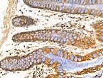 MRPL13 Antibody in Immunohistochemistry (Paraffin) (IHC (P))