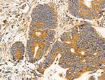 MRPL13 Antibody in Immunohistochemistry (Paraffin) (IHC (P))