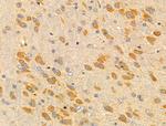 MRPL13 Antibody in Immunohistochemistry (Paraffin) (IHC (P))