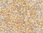 MRPL13 Antibody in Immunohistochemistry (Paraffin) (IHC (P))