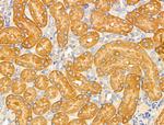 MRPL13 Antibody in Immunohistochemistry (Paraffin) (IHC (P))