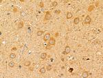 MRPL13 Antibody in Immunohistochemistry (Paraffin) (IHC (P))