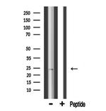 MRPL13 Antibody in Western Blot (WB)