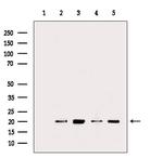 MRPL13 Antibody in Western Blot (WB)