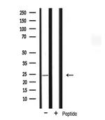 MRPL13 Antibody in Western Blot (WB)