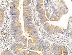 RPS18 Antibody in Immunohistochemistry (Paraffin) (IHC (P))