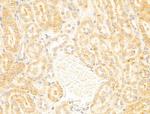 RPS18 Antibody in Immunohistochemistry (Paraffin) (IHC (P))