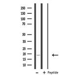 RPS18 Antibody in Western Blot (WB)