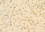 RPL5 Antibody in Immunohistochemistry (Paraffin) (IHC (P))