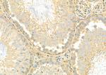 RPL5 Antibody in Immunohistochemistry (Paraffin) (IHC (P))