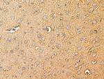 ACOT4 Antibody in Immunohistochemistry (Paraffin) (IHC (P))