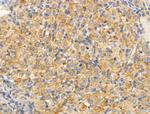 SLC25A6 Antibody in Immunohistochemistry (Paraffin) (IHC (P))