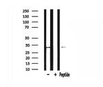 SLC25A6 Antibody in Western Blot (WB)