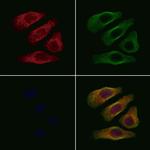 BST-1 Antibody in Immunocytochemistry (ICC/IF)