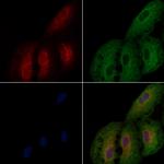 BST-1 Antibody in Immunocytochemistry (ICC/IF)