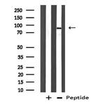 DDX54 Antibody in Western Blot (WB)