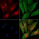 BOK Antibody in Immunocytochemistry (ICC/IF)