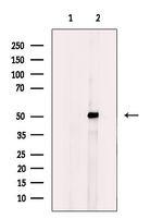 GCNT7 Antibody in Western Blot (WB)