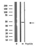 GCNT7 Antibody in Western Blot (WB)