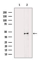 B4GALT1 Antibody in Western Blot (WB)