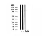 GUSB Antibody in Western Blot (WB)