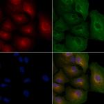 BMP-10 Antibody in Immunocytochemistry (ICC/IF)