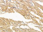 BMP-10 Antibody in Immunohistochemistry (Paraffin) (IHC (P))