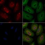 CHP1 Antibody in Immunocytochemistry (ICC/IF)