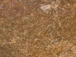 CHP1 Antibody in Immunohistochemistry (Paraffin) (IHC (P))