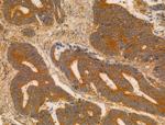 CHP1 Antibody in Immunohistochemistry (Paraffin) (IHC (P))