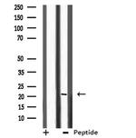 CHP1 Antibody in Western Blot (WB)