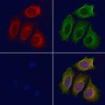 PDE4C Antibody in Immunocytochemistry (ICC/IF)