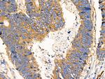 PDE4C Antibody in Immunohistochemistry (Paraffin) (IHC (P))