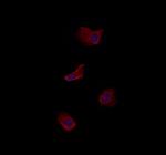 CLIP2 Antibody in Immunocytochemistry (ICC/IF)