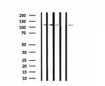 CLIP2 Antibody in Western Blot (WB)