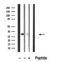 CTDSP1 Antibody in Western Blot (WB)