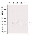 CTDSP1 Antibody in Western Blot (WB)