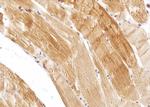 CPT1B Antibody in Immunohistochemistry (Paraffin) (IHC (P))