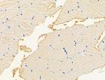 CPT1B Antibody in Immunohistochemistry (Paraffin) (IHC (P))