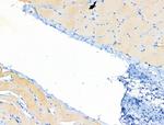 CPT1B Antibody in Immunohistochemistry (Paraffin) (IHC (P))