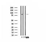 CPT1B Antibody in Western Blot (WB)