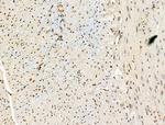 CEP57 Antibody in Immunohistochemistry (Paraffin) (IHC (P))