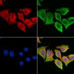 CLN6 Antibody in Immunocytochemistry (ICC/IF)