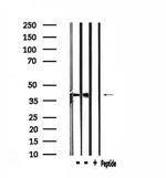 CLN6 Antibody in Western Blot (WB)