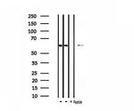 CLCC1 Antibody in Western Blot (WB)