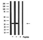 CMTM2 Antibody in Western Blot (WB)