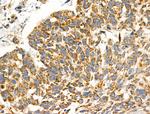 ST6GAL1 Antibody in Immunohistochemistry (Paraffin) (IHC (P))